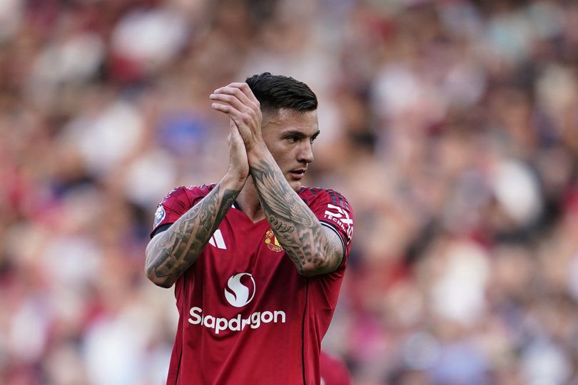 Ruben Amorim Punya 3 Opsi Pengganti Benjamin Sesko yang Cedera Lutut: MU Main Tanpa Penyerang Tengah?